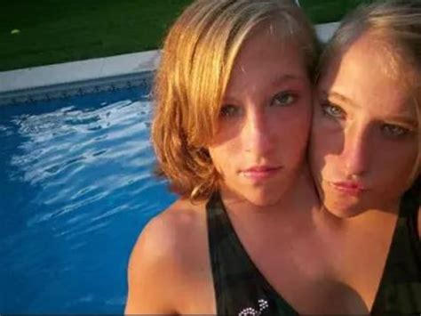 This Is What Famous Conjoined Twins Abby And Brittany Are