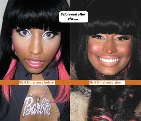 curvy body of nicki minaj before she was famous and after nose job