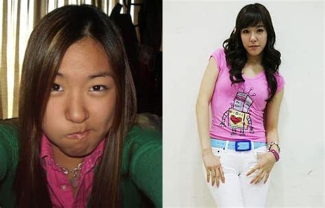 Tiffany Snsd Plastic Surgery Pic Before And After Celeb Surgery