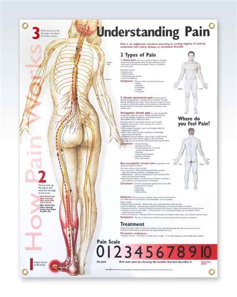 understanding pain exam room anatomy poster clinicalposters