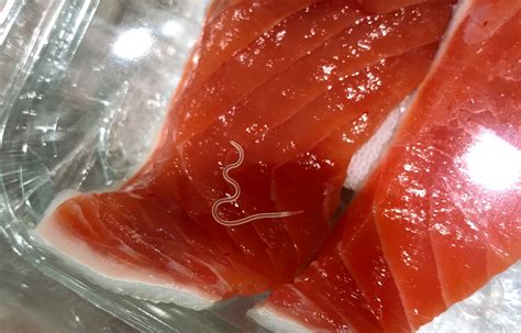 sushi parasites  increased  fold    years uw study finds localhealthguide