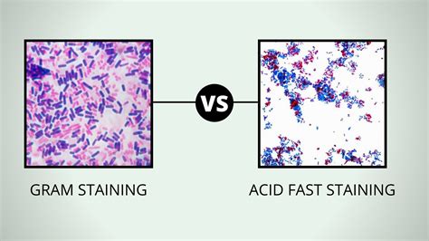 comparison  gram stain  acid fast