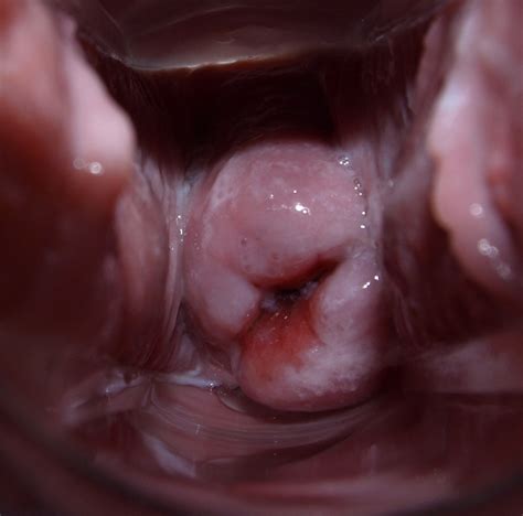 vagina after birth