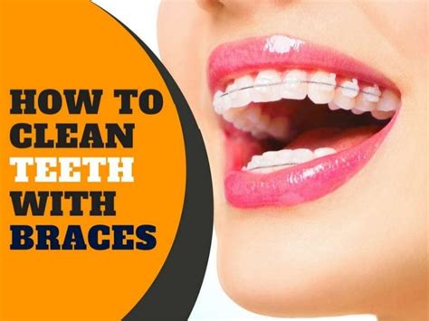 clean teeth  braces