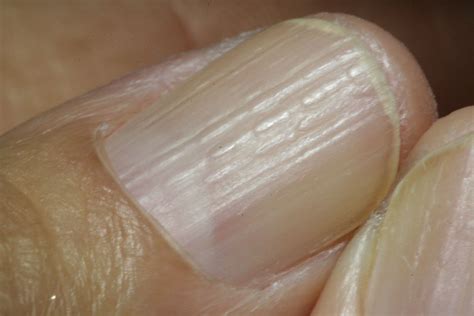 8 things your fingernails can reveal about your health