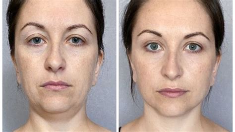 bid goodbye to facial fat with these simple facial exercises bid news
