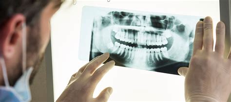 ortopantomografia dent