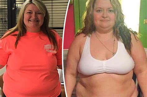 Extreme Weight Loss Size 24 Woman Sheds 10st 3lbs In Less Than Two