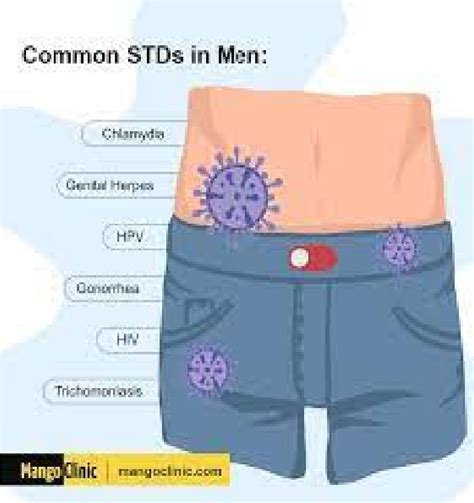 signs  symptoms  common stds  men ayv newspaper