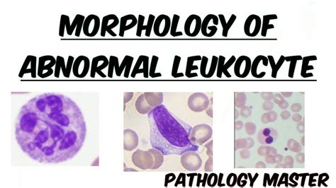 abnormal leukocyte morphology  peripheral blood smear images