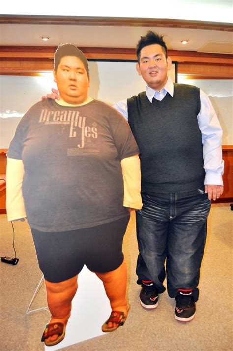 Teen Loses 100kg After Gastric Bypass Surgery Taipei Times