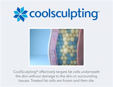 south bay med spa coolsculpting torrance med spa coolsculpting