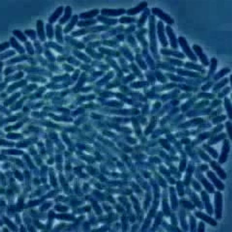 bacteria multiplying