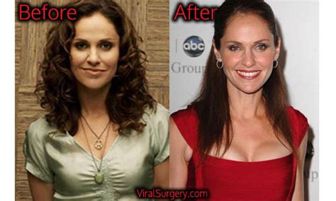 amy brenneman plastic surgery before after botox boob job pictures