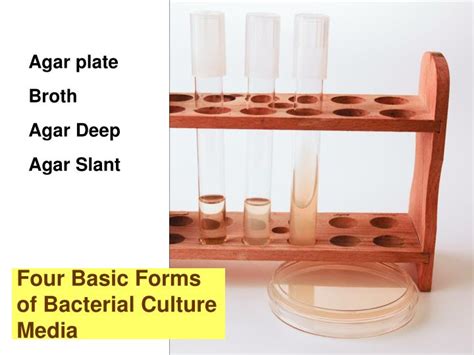 aseptic technique inoculating
