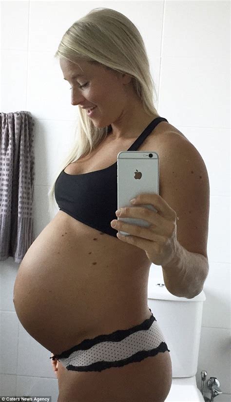 Mother Flaunts Her Abs 10 Weeks After Giving Birth And