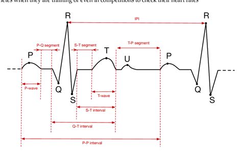 Electrocardiogram Explained