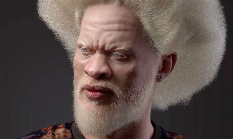 descubrir  imagen modelo albino famoso abzlocalmx