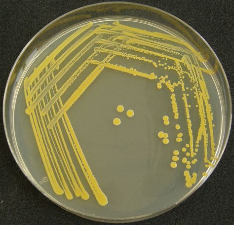 Staphylococcus Aureus Na Gtk Agaru