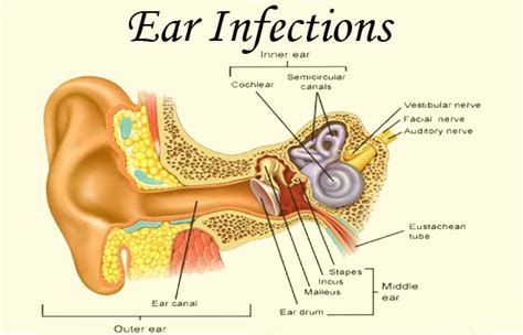 overview of ear infections