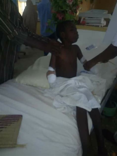 young boy crippled   beaten   teacher  gombe graphic photo torizone