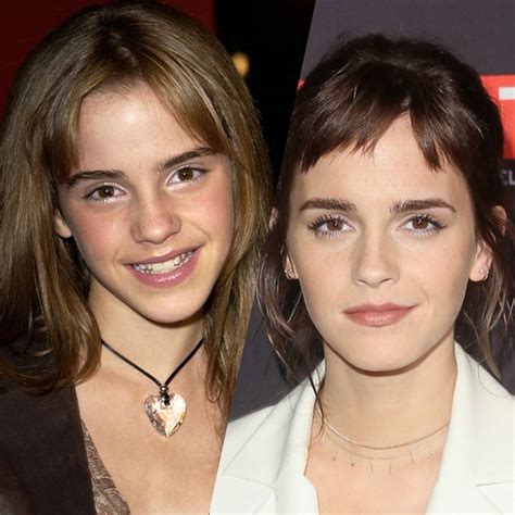 The Evolution Of Emma Watson S Beauty Photo Album