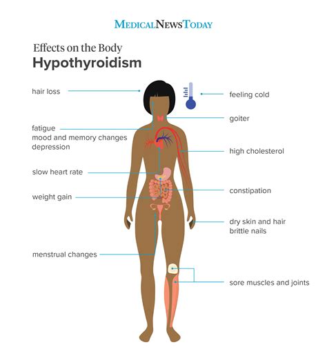 hypothyroidism symptoms 12 signs to look out for
