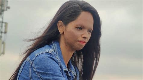 acid attack survivor laxmi agarwal stands  women  distress  lifestyle