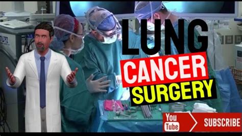 Lung Cancer Surgery Male Health Clinic
