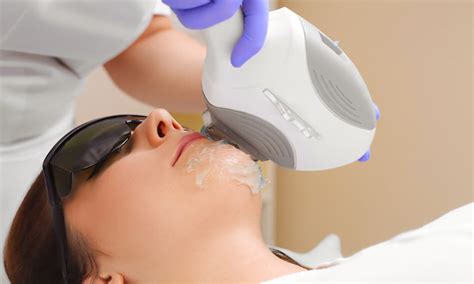 i p l treatments laser hair removal