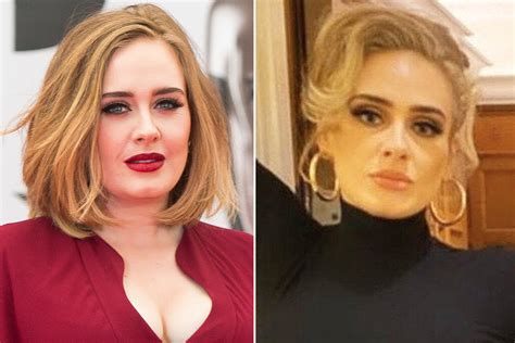 adele  plastic surgery doctors weigh    weight loss