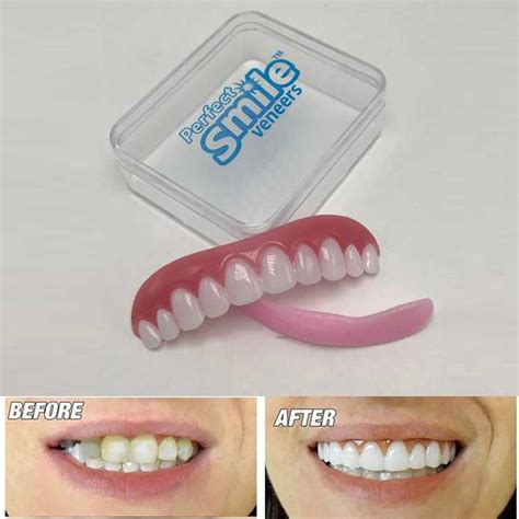 perfect smile instant smile comfort fit flex teeth top silicone cosmetic veneer lazada