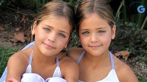 identical twin sisters deemed “most beautiful twins in the