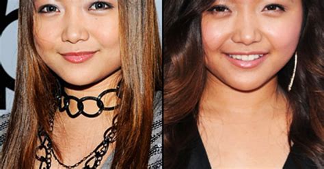 Charice Pempengco Plastic Surgeries Of The Year Us Weekly