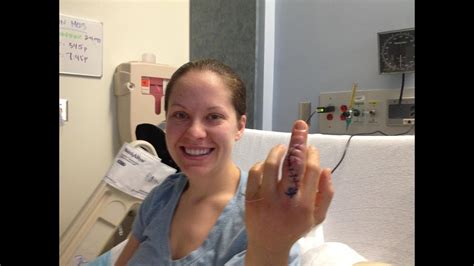 surgery on nasty finger infection for wife of redskins player youtube