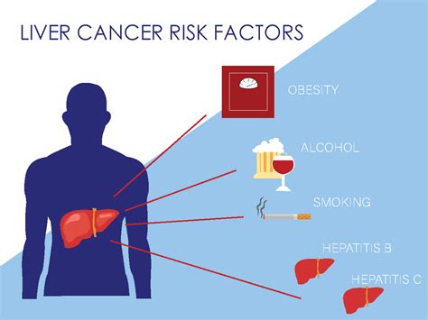 liver cancer awareness month    risk factors rocky