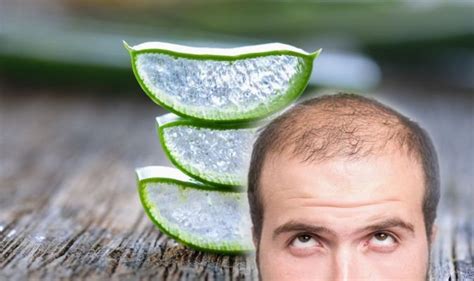 Hair Loss Treatment Rubbing Aloe Vera Gel Could Help Strengthen