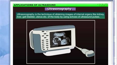 Applications Of Ultrasound Class 9th Cbse Chapter 12th Sound