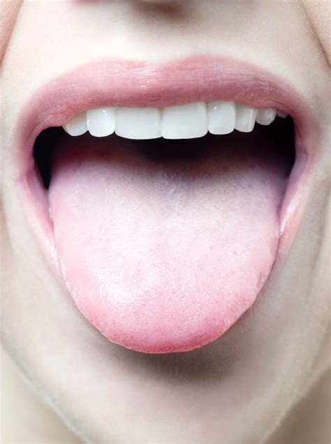 Your Snoring Could Be Caused By Having A Fat Tongue But Losing Weight