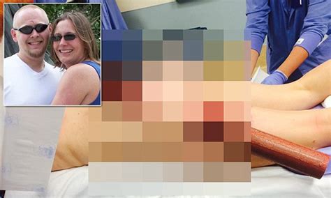 woman impaled by pole through her thigh while texting and driving daily mail online