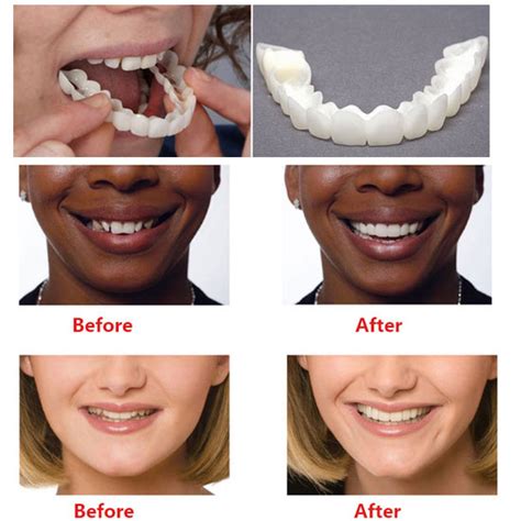 realistic fake teeth dental news network