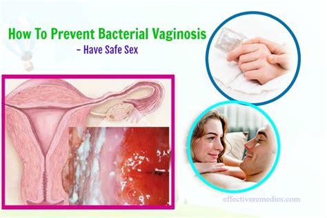 6 best tips on how to prevent bacterial vaginosis effectively