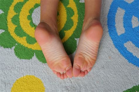 child suffering  severe foot pain nagy footcare