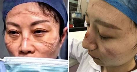 Chinese Nurses Pictures After Countless Hours Fighting The