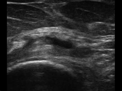 Musculoskeletal Joints And Tendons 6 5 Hip Groin And Buttock Case 6