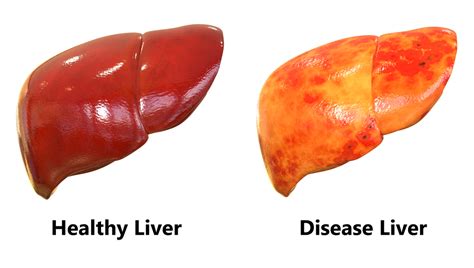 essential facts   liver