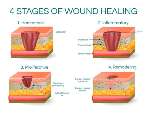 stages  wound healing wound healing healing color change