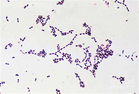lm  colony  bacillus cereus bacteria photograph  john durham