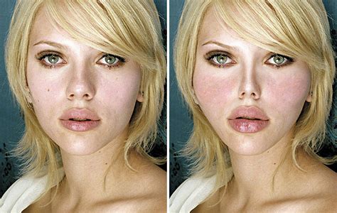 10 celebrities faces before and after surgery celebrity