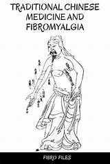 Fibromyalgia Fibro Acupuncture Intensity Lessens sketch template